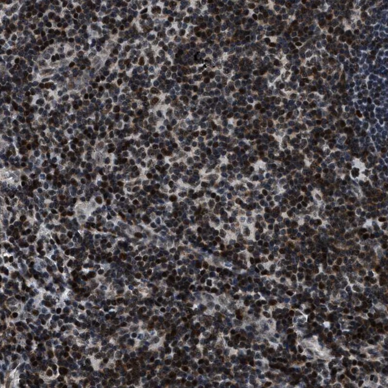 SNF5 Antibody - BSA Free Immunohistochemistry-Paraffin: SNF5 Antibody - BSA Free [NBP1-90014]