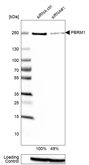 BAF180/PB1 Antibody - BSA Free Western Blot: BAF180/PB1 Antibody - BSA Free [NBP1-90016]