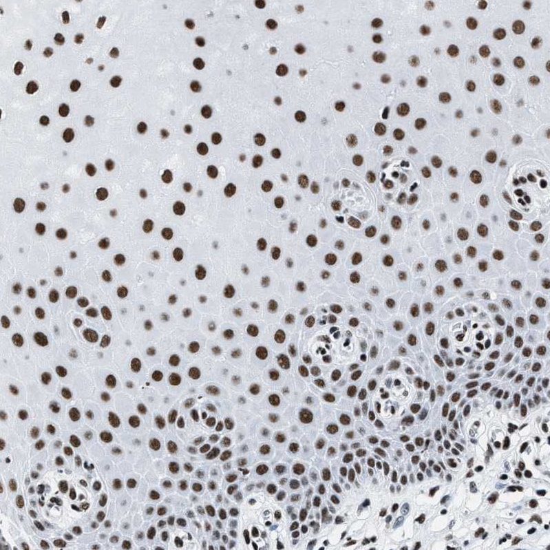SMARCC2/BAF170 Antibody - BSA Free Immunohistochemistry-Paraffin: SMARCC2/BAF170 Antibody - BSA Free [NBP1-90017]