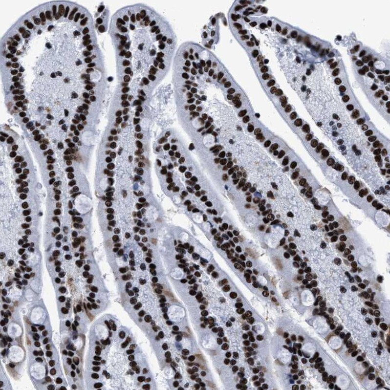 SMARCC2/BAF170 Antibody - BSA Free Immunohistochemistry-Paraffin: SMARCC2/BAF170 Antibody - BSA Free [NBP1-90017]