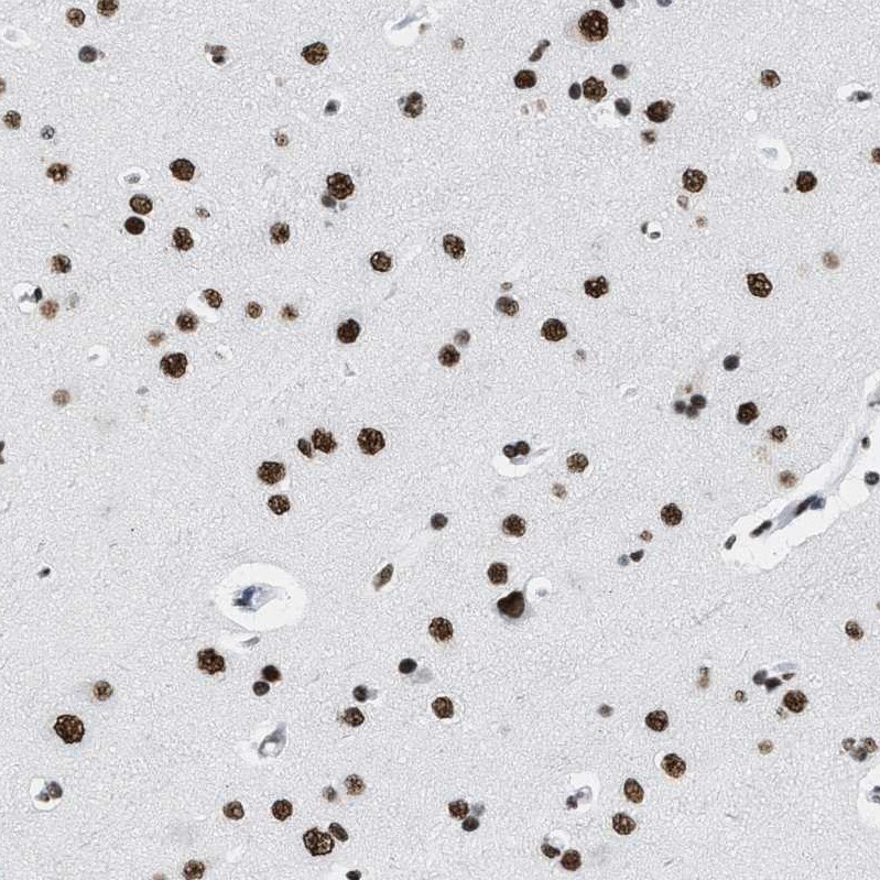 SMARCC2/BAF170 Antibody - BSA Free Immunohistochemistry-Paraffin: SMARCC2/BAF170 Antibody - BSA Free [NBP1-90017]