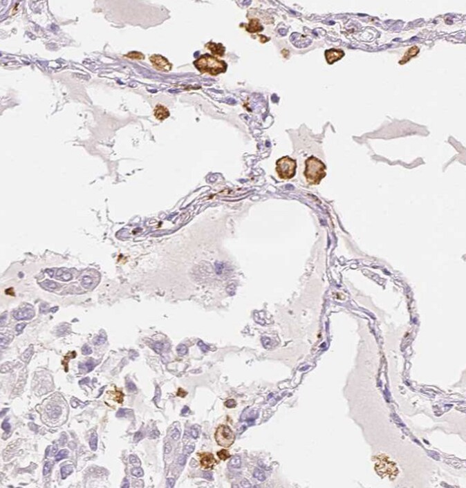 MMR/CD206/Mannose Receptor Antibody - BSA Free