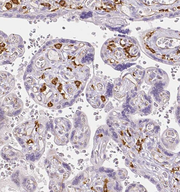 MMR/CD206/Mannose Receptor Antibody - BSA Free