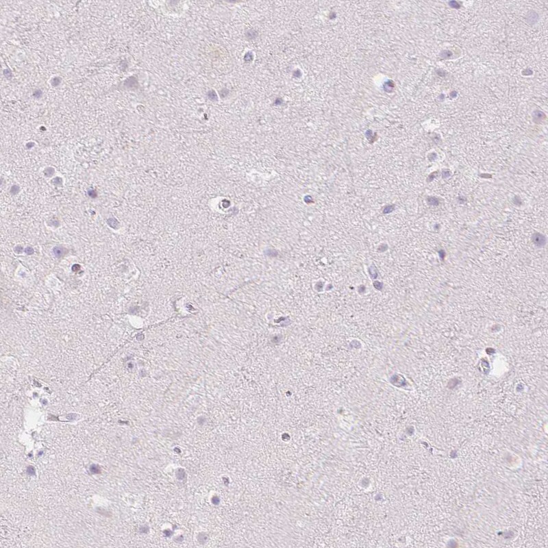 MMR/CD206/Mannose Receptor Antibody - BSA Free Immunohistochemistry-Paraffin: MMR/CD206/Mannose Receptor Antibody - BSA Free [NBP1-90020]