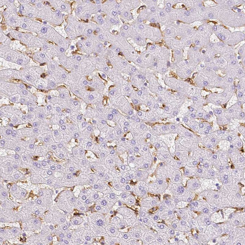 MMR/CD206/Mannose Receptor Antibody - BSA Free Immunohistochemistry-Paraffin: MMR/CD206/Mannose Receptor Antibody - BSA Free [NBP1-90020]