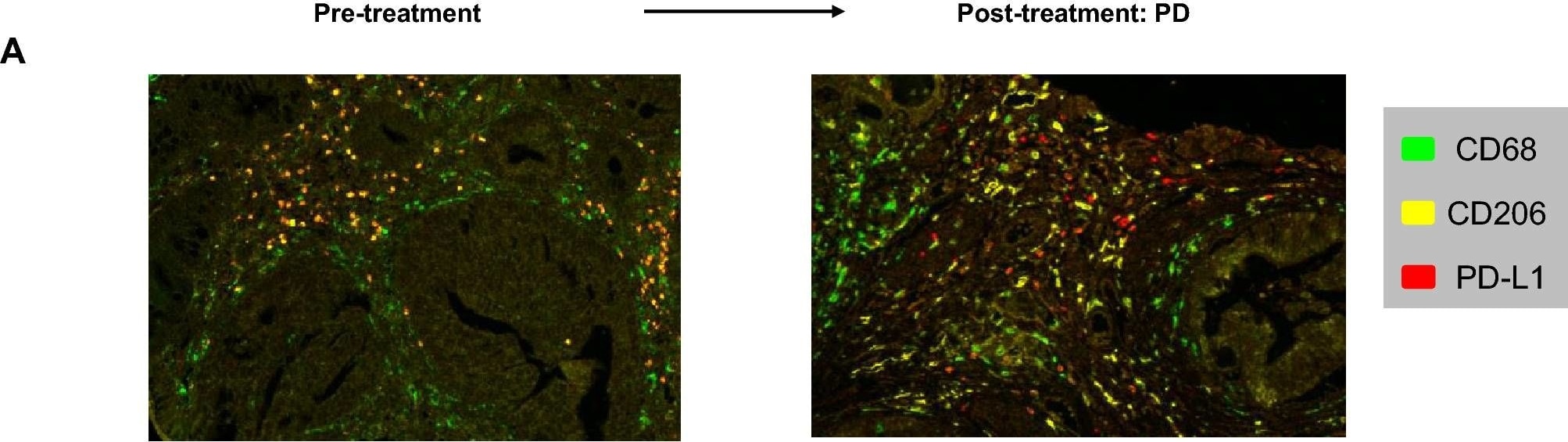 MMR/CD206/Mannose Receptor Antibody - BSA Free