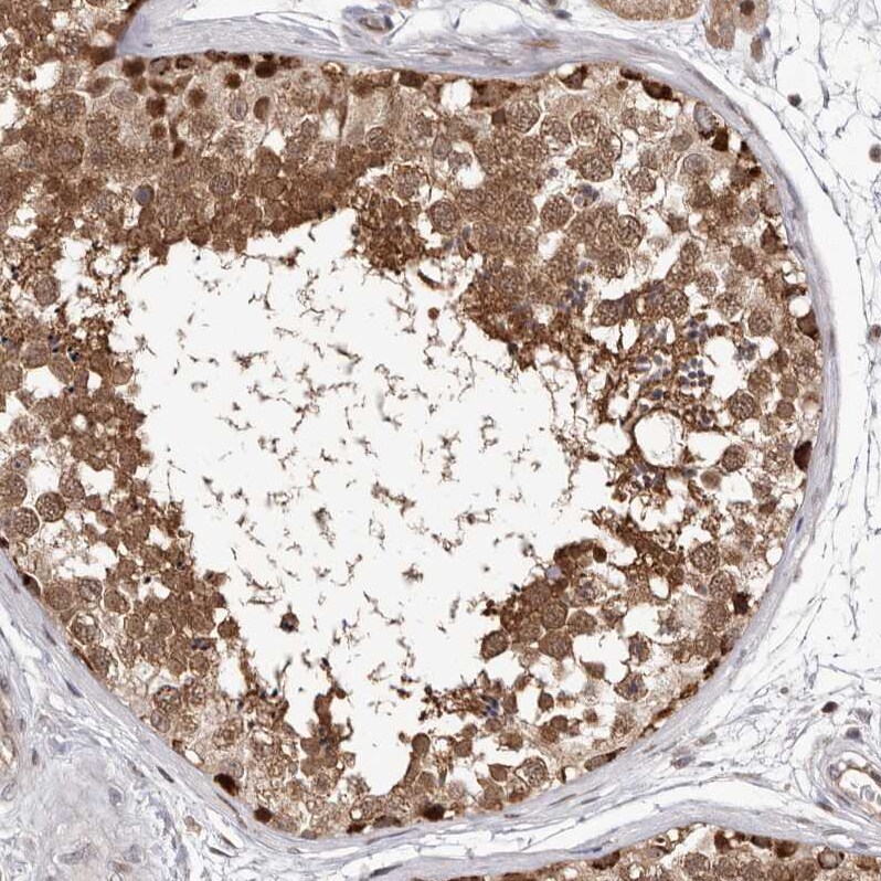 Glutaredoxin 3/GLRX3 Antibody - BSA Free Immunohistochemistry-Paraffin: Glutaredoxin 3/GLRX3 Antibody - BSA Free [NBP1-90021]