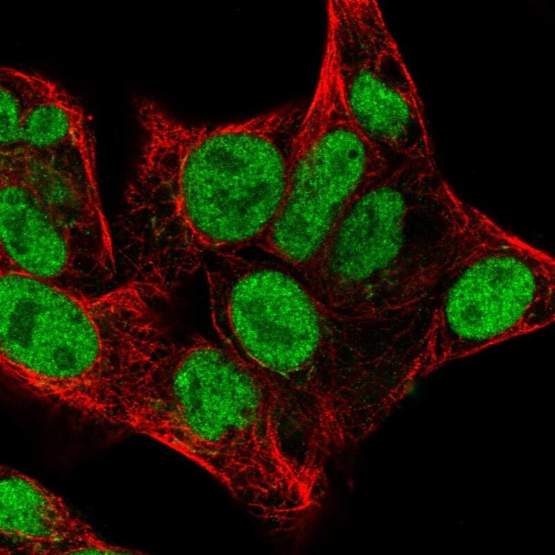 Chk2 Antibody - BSA Free Immunocytochemistry/ Immunofluorescence: Chk2 Antibody [NBP1-90024]
