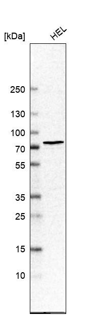 Chk2 Antibody - BSA Free Western Blot: Chk2 Antibody - BSA Free [NBP1-90024]