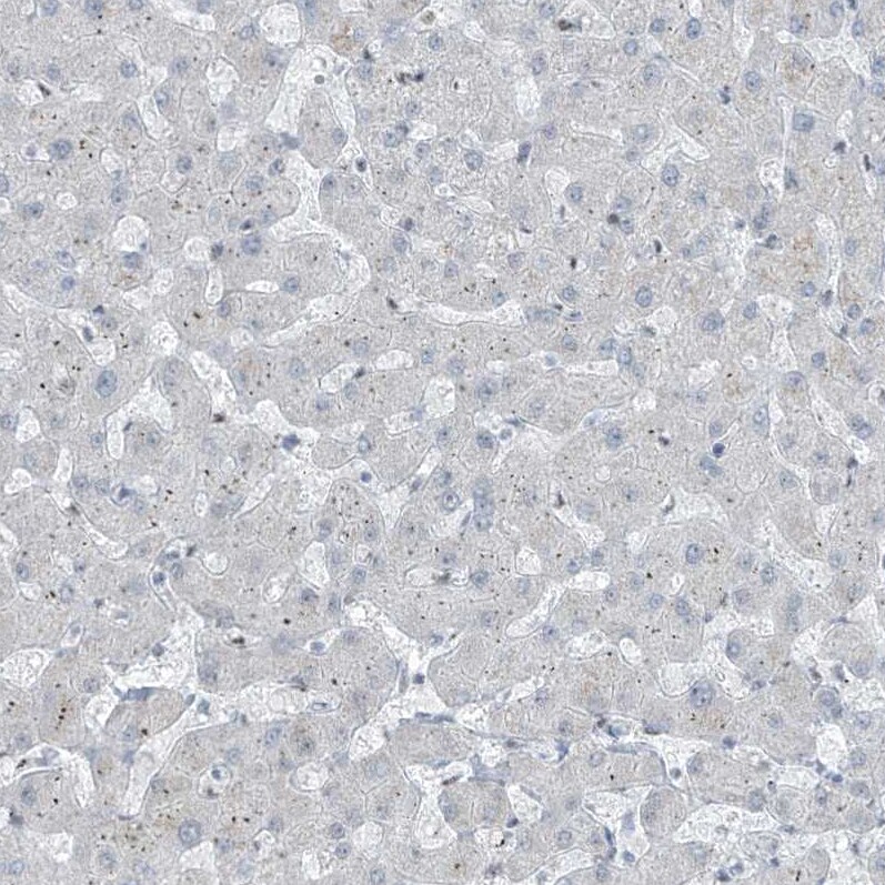 WHIP Antibody - BSA Free Immunohistochemistry-Paraffin: WHIP Antibody [NBP1-90030]