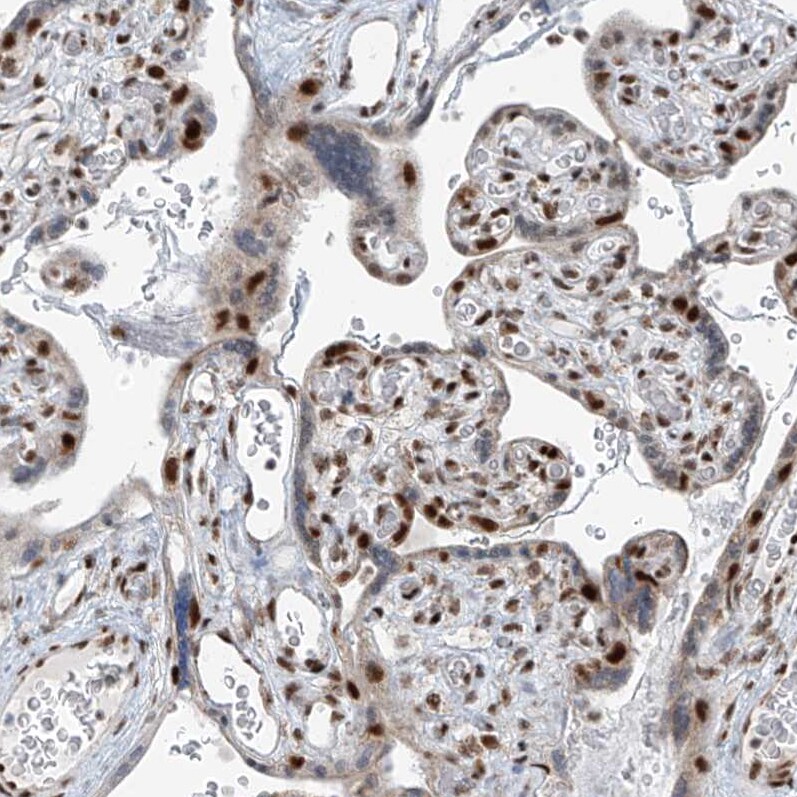 WHIP Antibody - BSA Free Immunohistochemistry-Paraffin: WHIP Antibody [NBP1-90030]