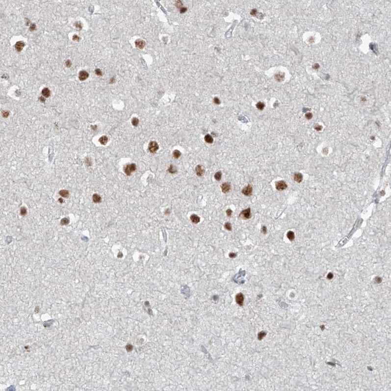 WHIP Antibody - BSA Free Immunohistochemistry-Paraffin: WHIP Antibody [NBP1-90030]