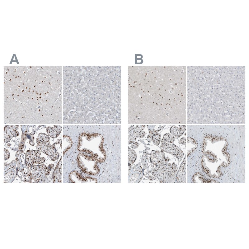 WHIP Antibody - BSA Free Immunohistochemistry-Paraffin: WHIP Antibody [NBP1-90030]