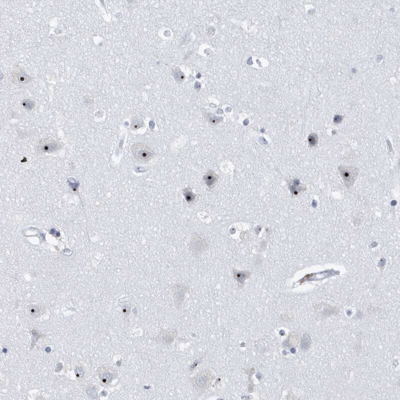 BXDC1 Antibody - BSA Free Immunohistochemistry-Paraffin: BXDC1 Antibody [NBP1-90031]