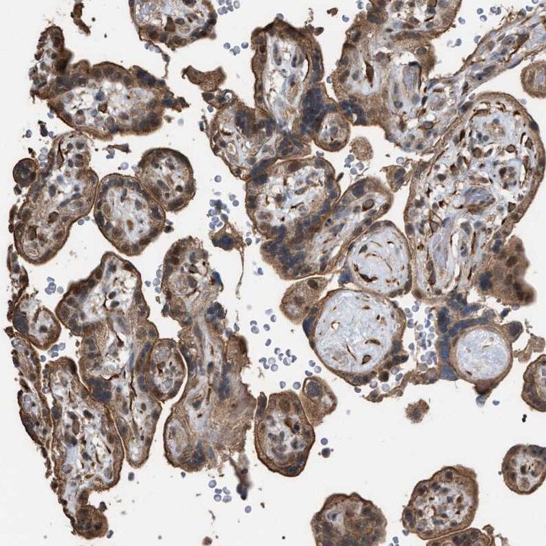 MAK10 Antibody - BSA Free Immunohistochemistry-Paraffin: MAK10 Antibody - BSA Free [NBP1-90032]