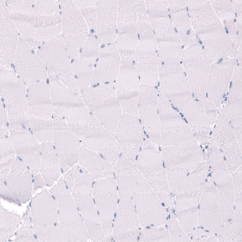 EYS/RP25 Antibody - BSA Free Immunohistochemistry-Paraffin: EYS/RP25 Antibody - BSA Free [NBP1-90038]