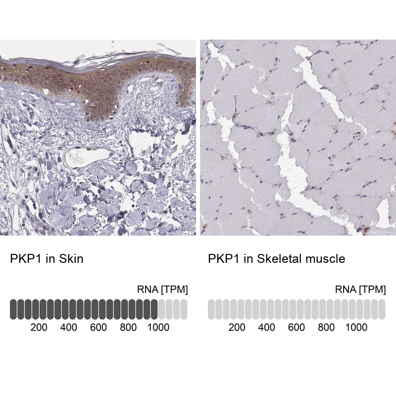 Plakophilin 1 Antibody - BSA Free Immunohistochemistry-Paraffin: Plakophilin 1 Antibody - BSA Free [NBP1-90042]