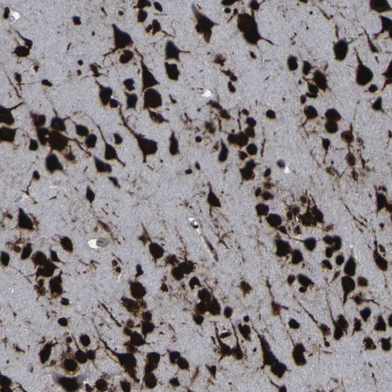 NPM1 Antibody - BSA Free Immunohistochemistry-Paraffin: NPM1 Antibody [NBP1-90047]