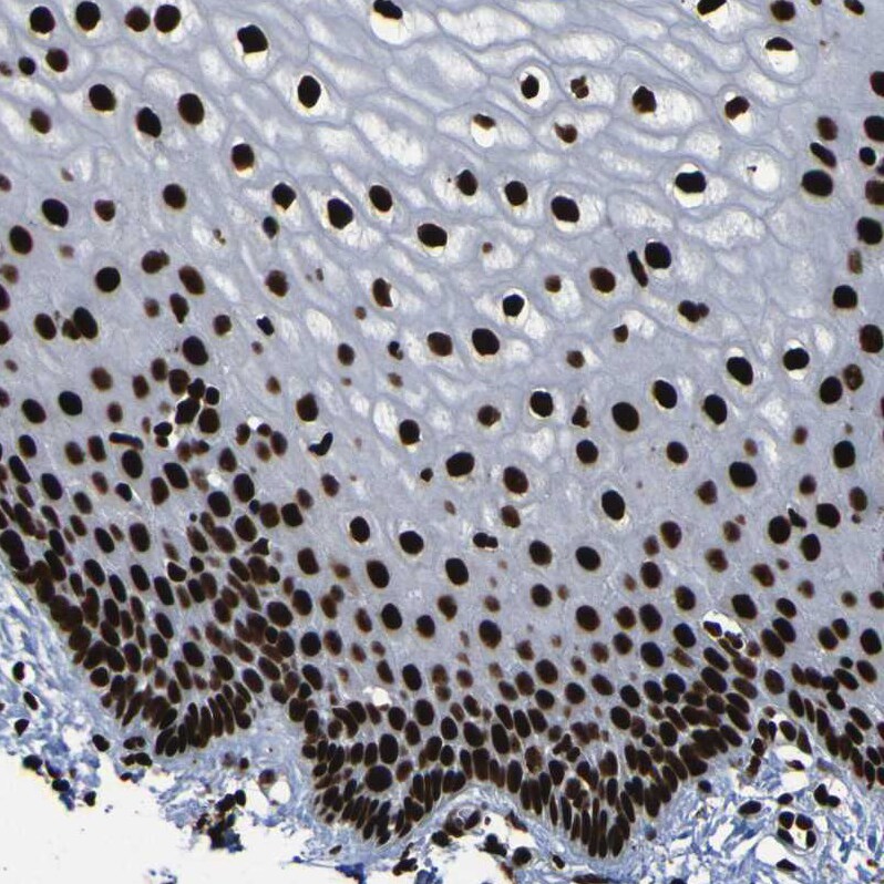 NPM1 Antibody - BSA Free Immunohistochemistry-Paraffin: NPM1 Antibody [NBP1-90047]