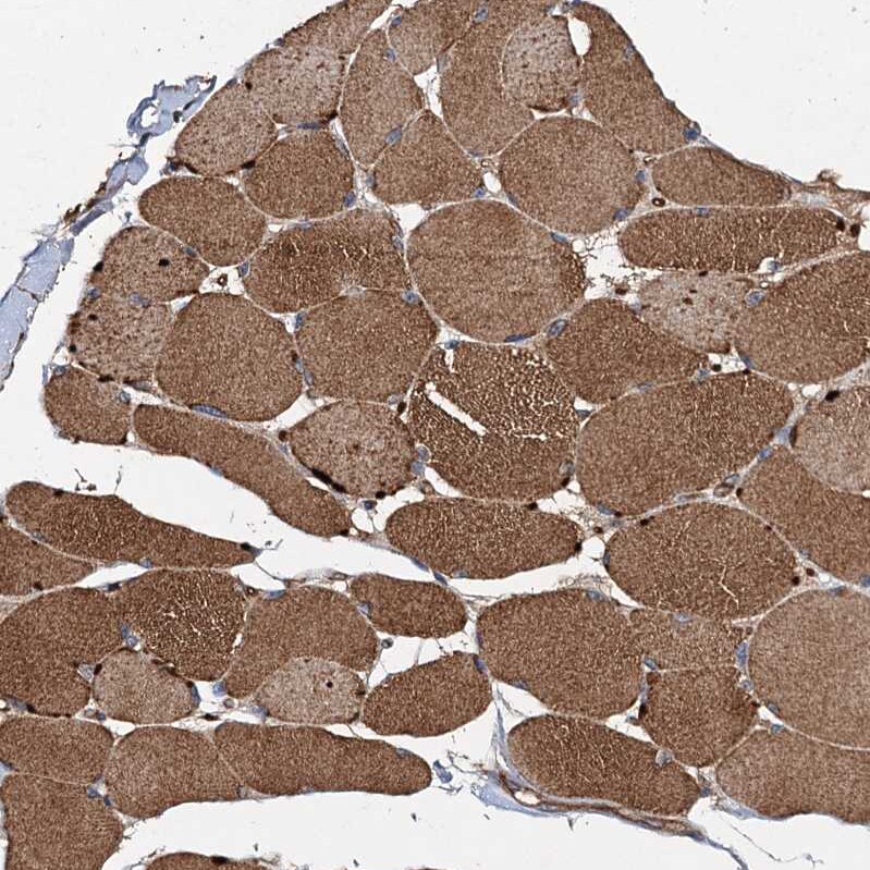 GRIM19 Antibody - BSA Free Immunohistochemistry: GRIM19 Antibody - BSA Free [NBP1-90050]