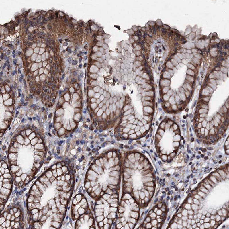 GRIM19 Antibody - BSA Free Immunohistochemistry: GRIM19 Antibody - BSA Free [NBP1-90050]