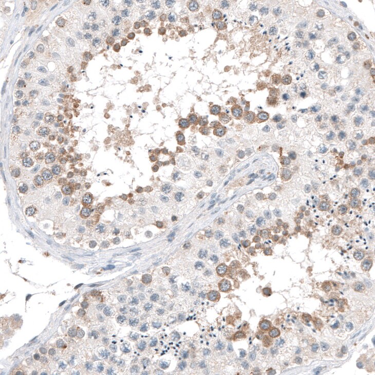 AZ1 Antibody - BSA Free Immunohistochemistry-Paraffin: AZ1 Antibody [NBP1-90053]