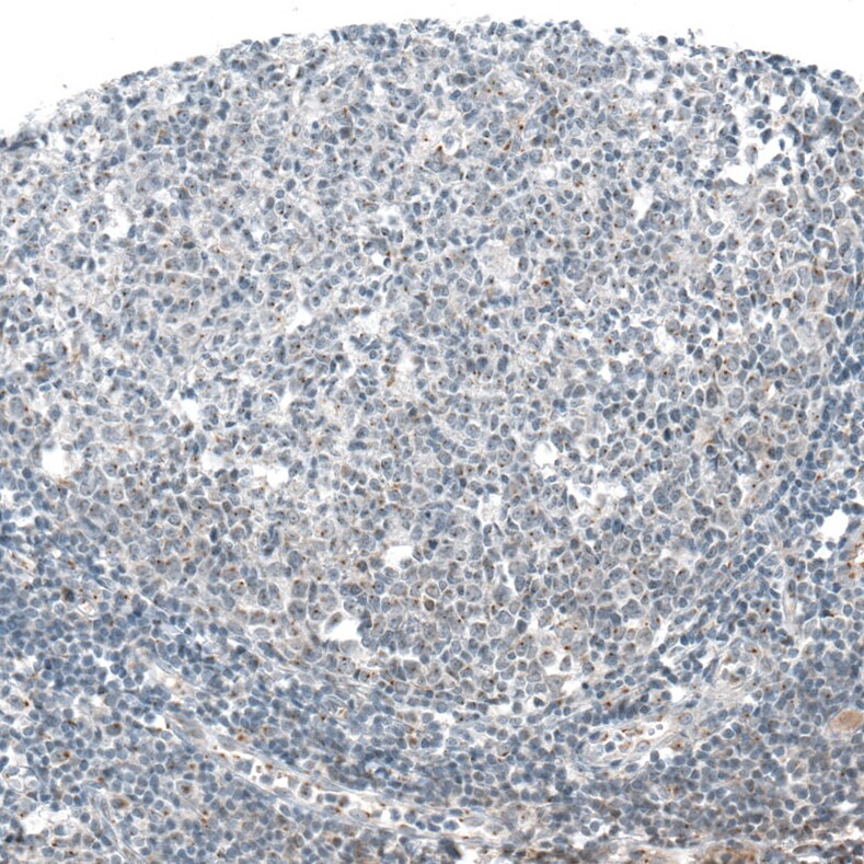 AZ1 Antibody - BSA Free Immunohistochemistry-Paraffin: AZ1 Antibody [NBP1-90053]