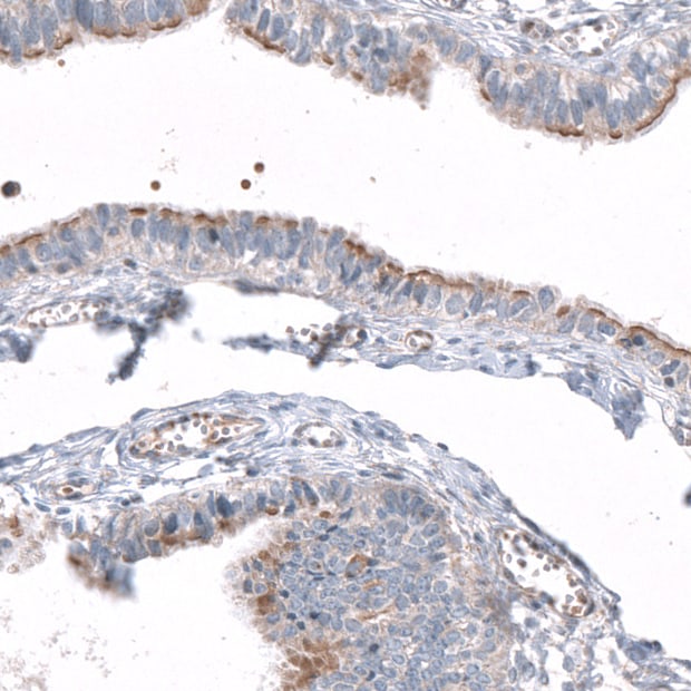 AZ1 Antibody - BSA Free Immunohistochemistry-Paraffin: AZ1 Antibody [NBP1-90053]