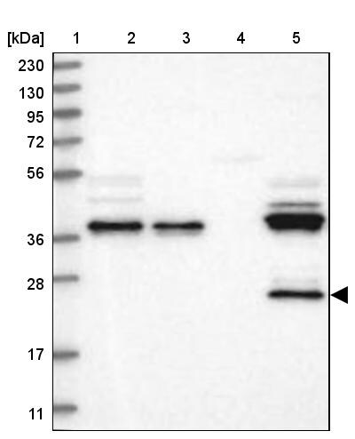 ZA20D3 Antibody - BSA Free Western Blot: ZA20D3 Antibody - BSA Free [NBP1-90060]