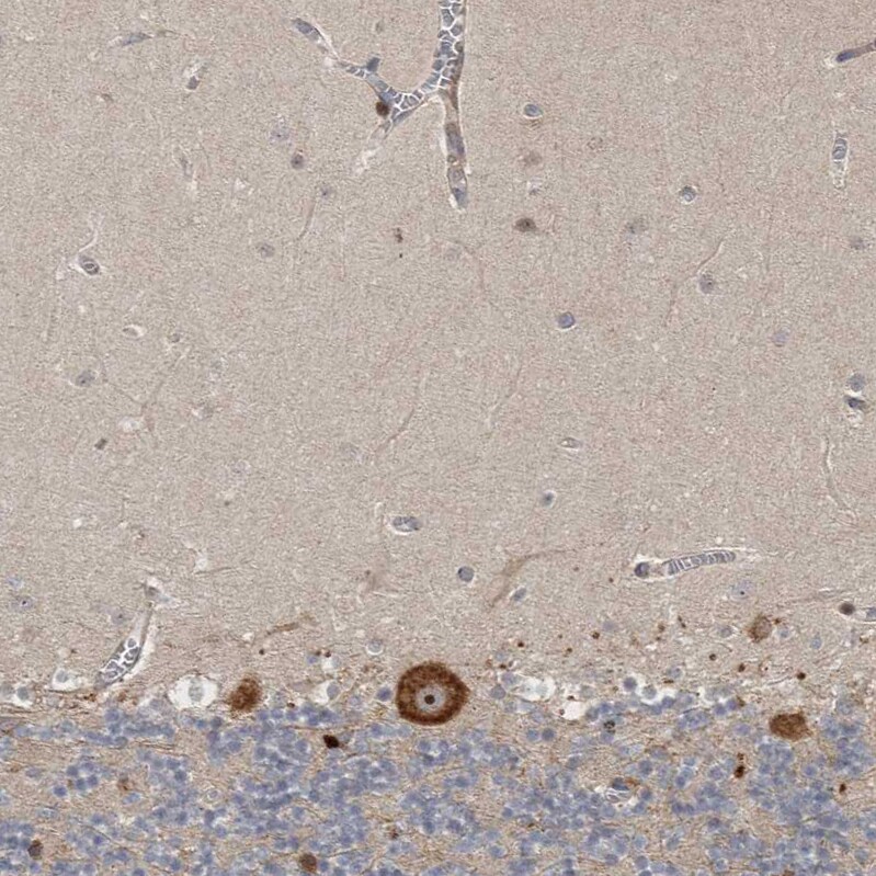 Ataxin-2 Antibody - BSA Free Immunohistochemistry: Ataxin-2 Antibody - BSA Free [NBP1-90064]