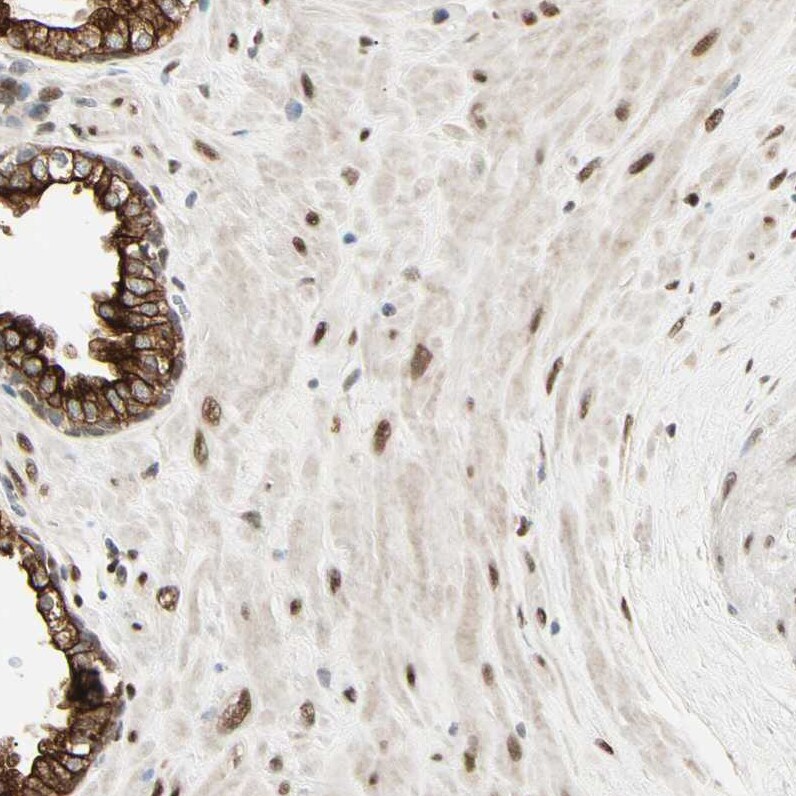 Ataxin 1 Antibody - BSA Free Immunohistochemistry: Ataxin 1 Antibody - BSA Free [NBP1-90065]
