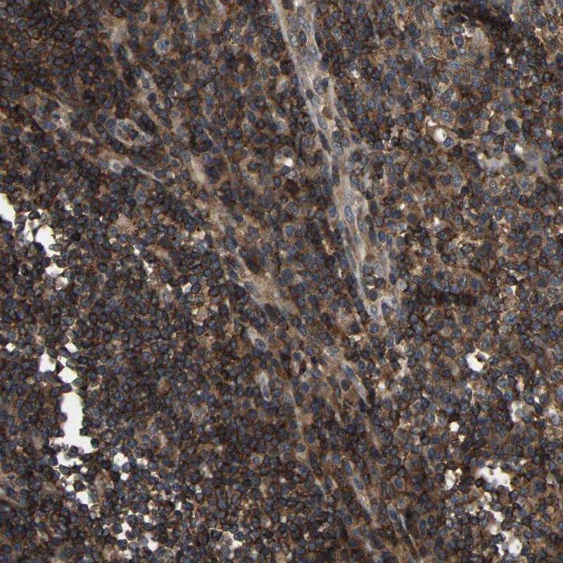 BRIC Antibody - BSA Free Immunohistochemistry-Paraffin: BRIC Antibody [NBP1-90068]