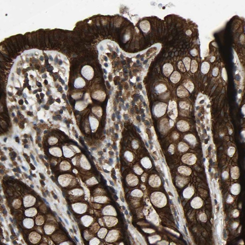 BRIC Antibody - BSA Free Immunohistochemistry-Paraffin: BRIC Antibody [NBP1-90068]