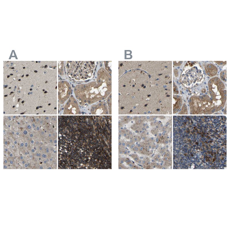 BRIC Antibody - BSA Free Immunohistochemistry-Paraffin: BRIC Antibody [NBP1-90068]