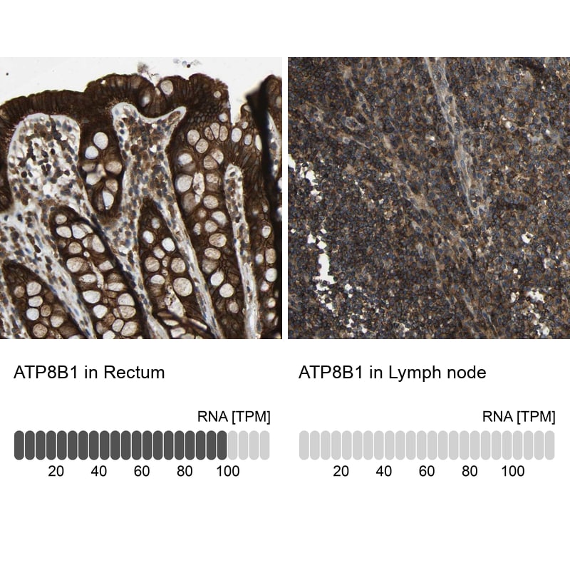BRIC Antibody - BSA Free Immunohistochemistry: BRIC Antibody - BSA Free [NBP1-90068]