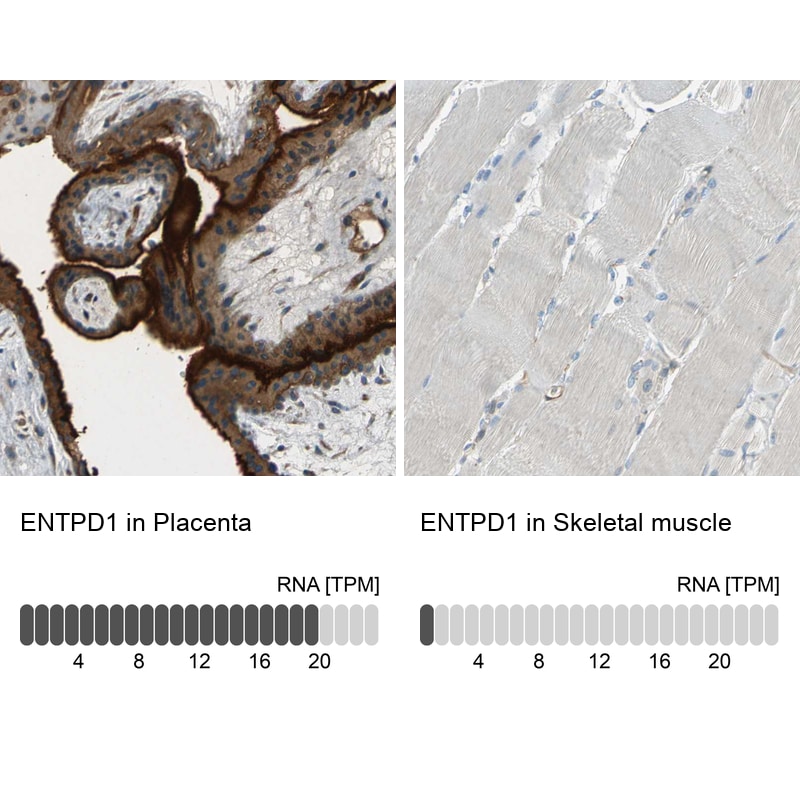 CD39/ENTPD1 Antibody - BSA Free Immunohistochemistry: CD39/ENTPD1 Antibody - BSA Free [NBP1-90071]