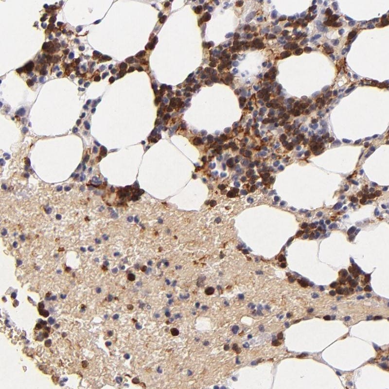 Serpin C1/Antithrombin-III Antibody - BSA Free Immunohistochemistry: Serpin C1/Antithrombin-III Antibody - BSA Free [NBP1-90076]