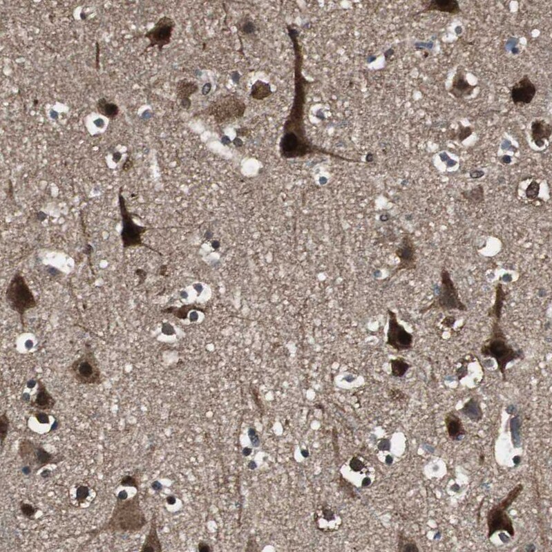 ASPP1 Antibody - BSA Free Immunohistochemistry: ASPP1 Antibody - BSA Free [NBP1-90078]