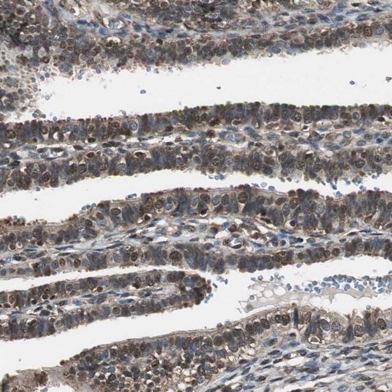 ASPP1 Antibody - BSA Free Immunohistochemistry: ASPP1 Antibody - BSA Free [NBP1-90078]