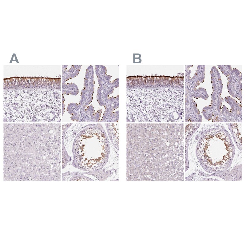 Ropporin 1-like Antibody - BSA Free Immunohistochemistry: Ropporin 1-like Antibody - BSA Free [NBP1-90081]