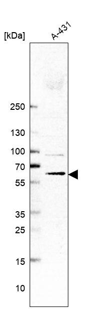 Membralin Antibody - BSA Free Western Blot: Membralin Antibody - BSA Free [NBP1-90088]