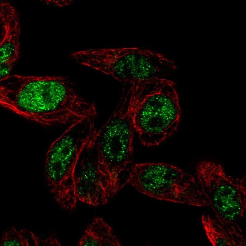 Septin-4 Antibody - BSA Free Immunocytochemistry/ Immunofluorescence: Septin-4 Antibody [NBP1-90093]