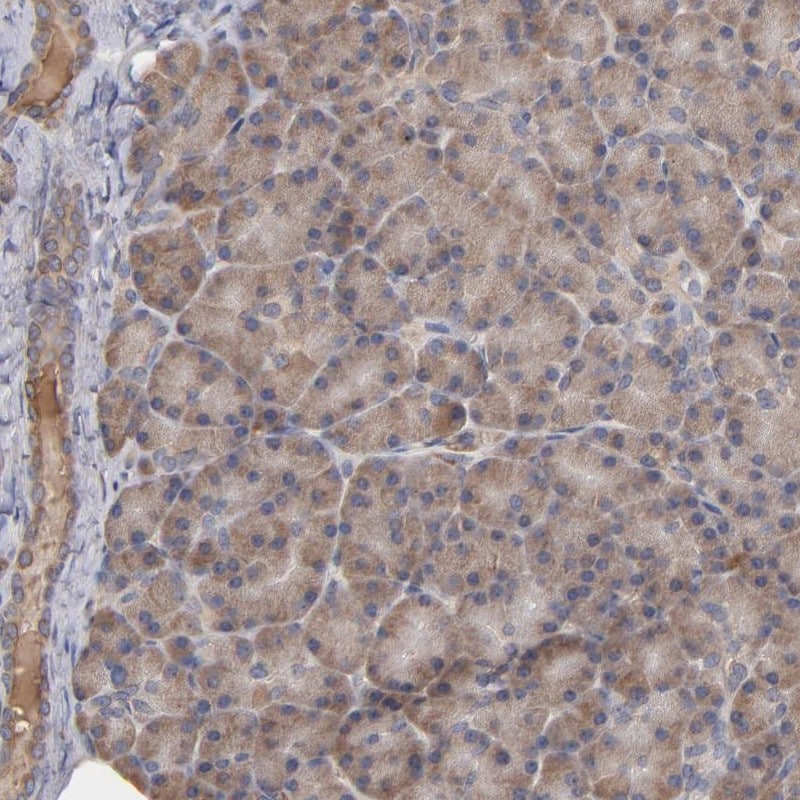 Steroid sulfatase Antibody - BSA Free Immunohistochemistry-Paraffin: Steroid sulfatase Antibody - BSA Free [NBP1-90095]
