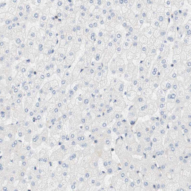 Cytohesin 3 Antibody - BSA Free Immunohistochemistry: Cytohesin 3 Antibody - BSA Free [NBP1-90097]
