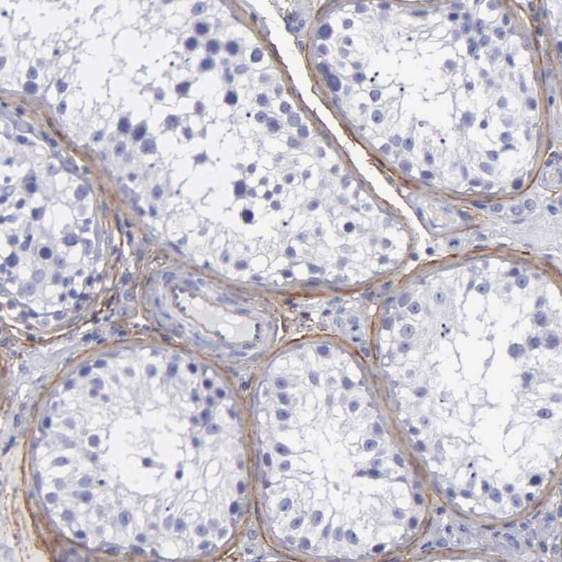 Fibulin 5/DANCE Antibody - BSA Free Immunohistochemistry: Fibulin 5/DANCE Antibody - BSA Free [NBP1-90100]