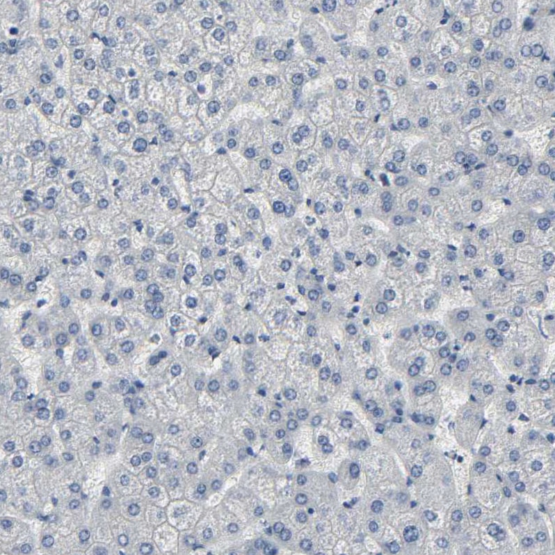 Fibulin 5/DANCE Antibody - BSA Free Immunohistochemistry: Fibulin 5/DANCE Antibody - BSA Free [NBP1-90101]