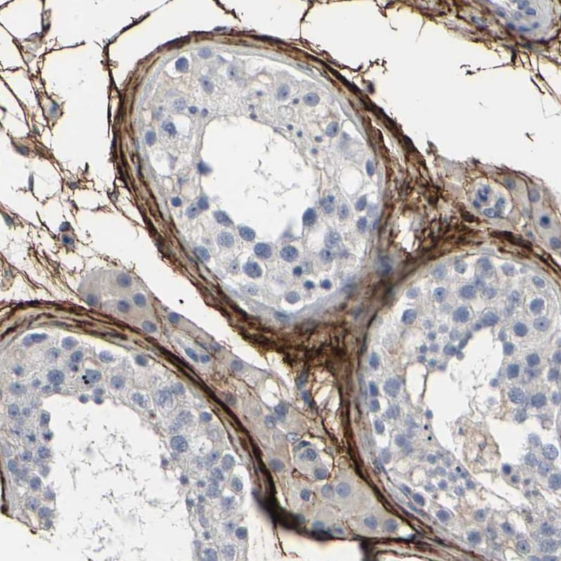 Fibulin 5/DANCE Antibody - BSA Free Immunohistochemistry: Fibulin 5/DANCE Antibody - BSA Free [NBP1-90101]
