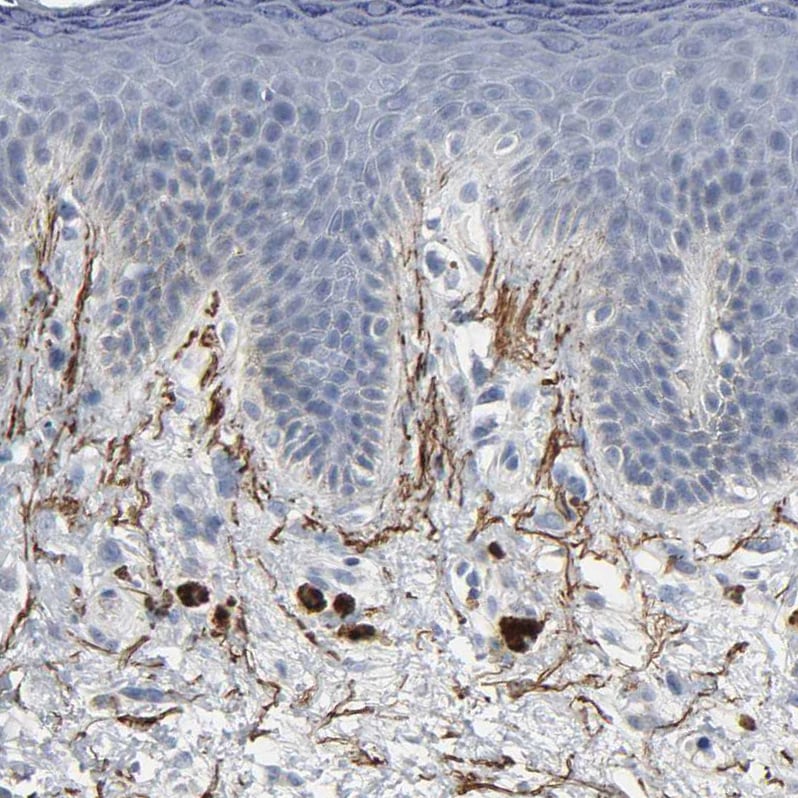 Fibulin 5/DANCE Antibody - BSA Free Immunohistochemistry: Fibulin 5/DANCE Antibody - BSA Free [NBP1-90101]