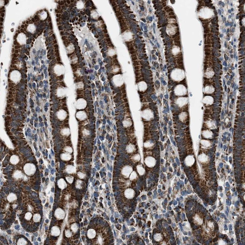 Chimaerin 2 Antibody - BSA Free Immunohistochemistry: Chimaerin 2 Antibody - BSA Free [NBP1-90108]