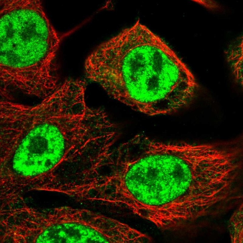 NIPP1 Antibody - BSA Free Immunocytochemistry/ Immunofluorescence: NIPP1 Antibody - BSA Free [NBP1-90111]
